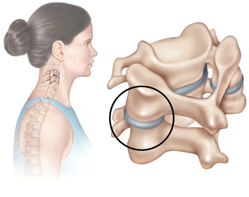 Facet Joint