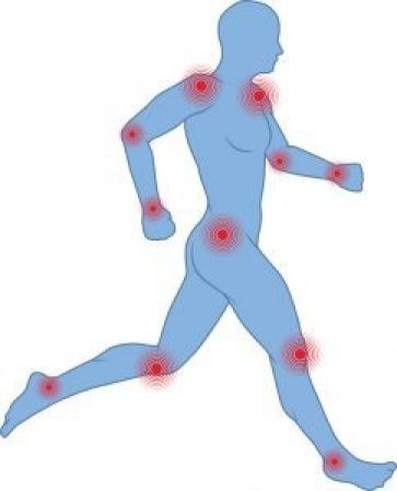 Common Sites of Tendinopathy