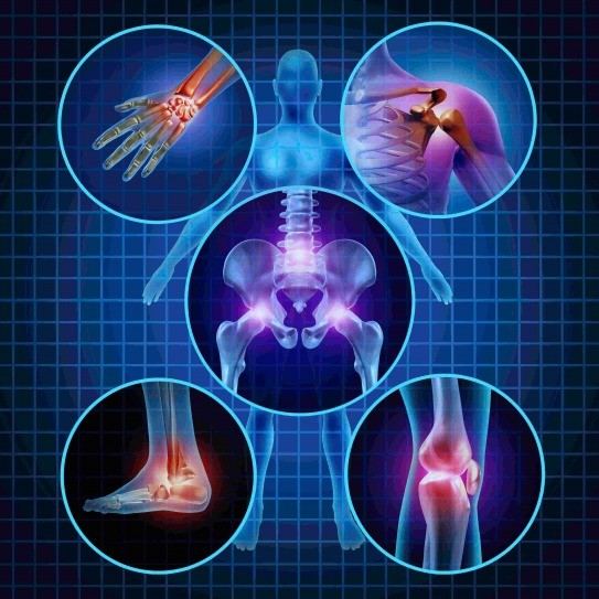 Illustration of the body highlighting painful joints: wrist, shoulder, hips, ankle and knee