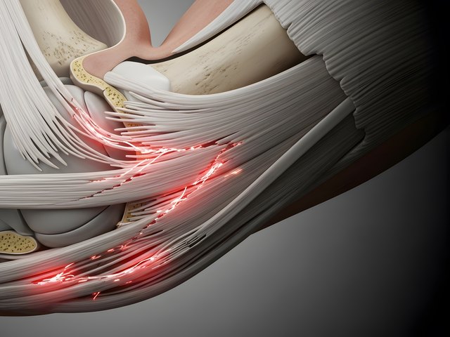 Tendons: Springing into Action